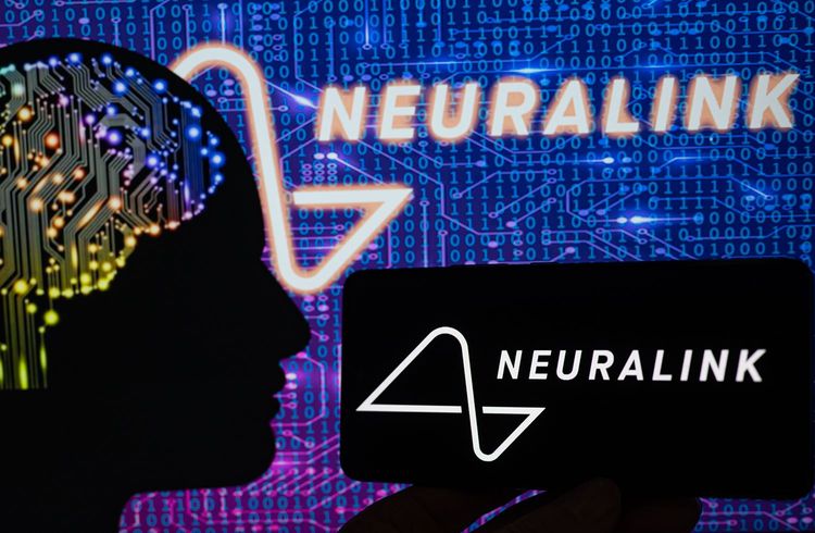 Neuralink startet klinische Studie