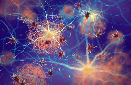 Alzheimer-Medikamentenstudie: Wissenschaft am Scheideweg