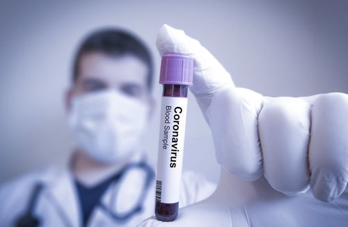 Impfstoffhersteller müssen Umsatzeinbußen hinnehmen, da die Nachfrage nach Covid-Impfstoffen sinkt